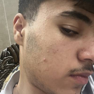 ياسر
